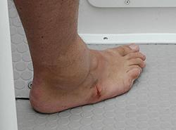 Foot2.jpg